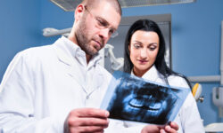 Vytažení (extrakce) zubů moudrosti